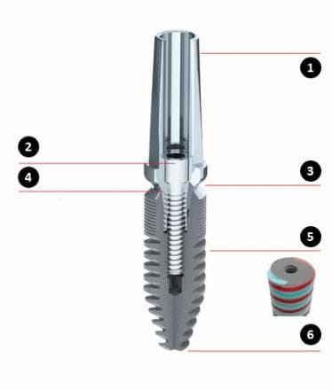 Evoss İmplant insertion