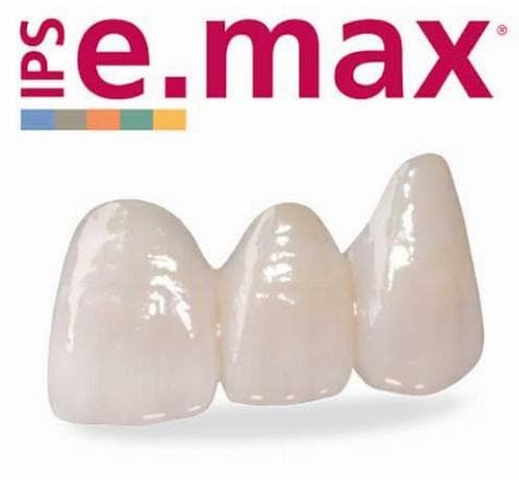 Emax Veneers