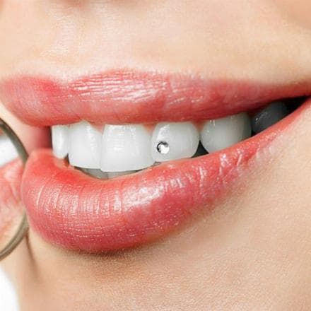 Tooth gems (zirconia)
