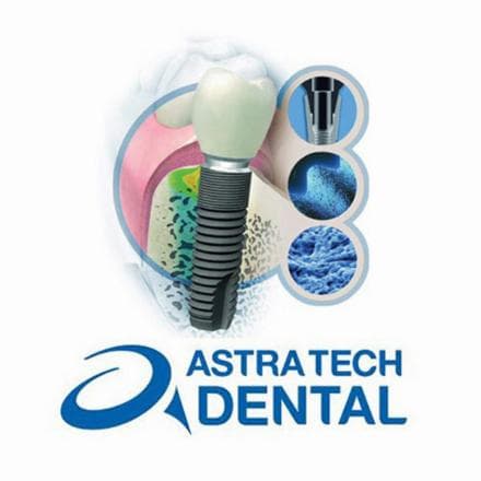 Astra Tech implants