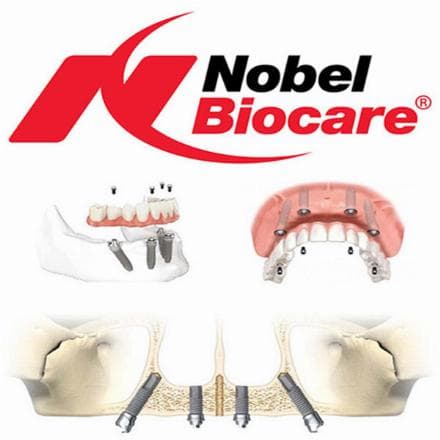 Nobel Biocare implants